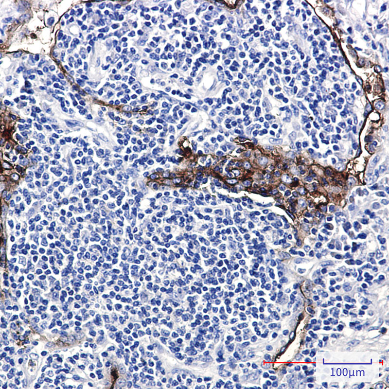 IHC - Folate Binding Protein Rabbit mAb AP75447